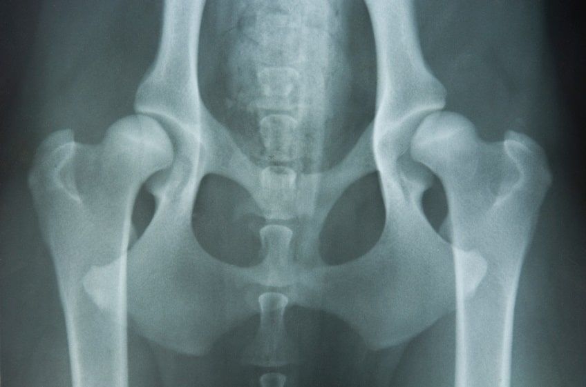 dysplazja stawu biodrowego-min.jpg