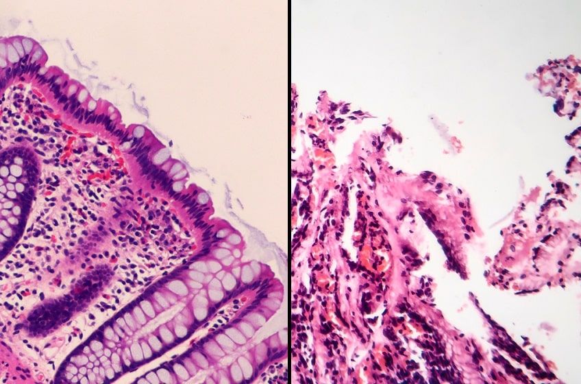 zdrowe błony śluzowe-min.jpg